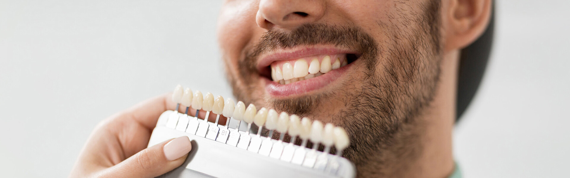 5 Advantages of Dental Veneers in Houston