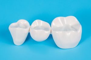 Dental Crowns are a popular method used to restore natural teeth.