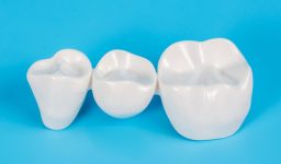 Modern Dental Crowns Are Often The Go To Solution